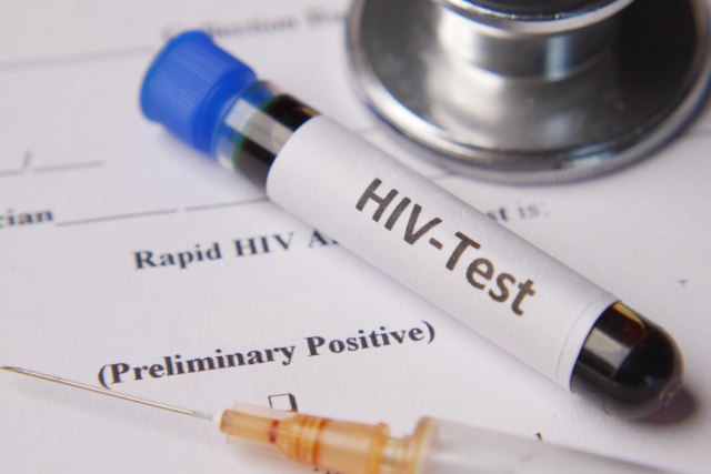 Pravo poreklo HIV virusa: Šta su naučnici do sada otkrili?